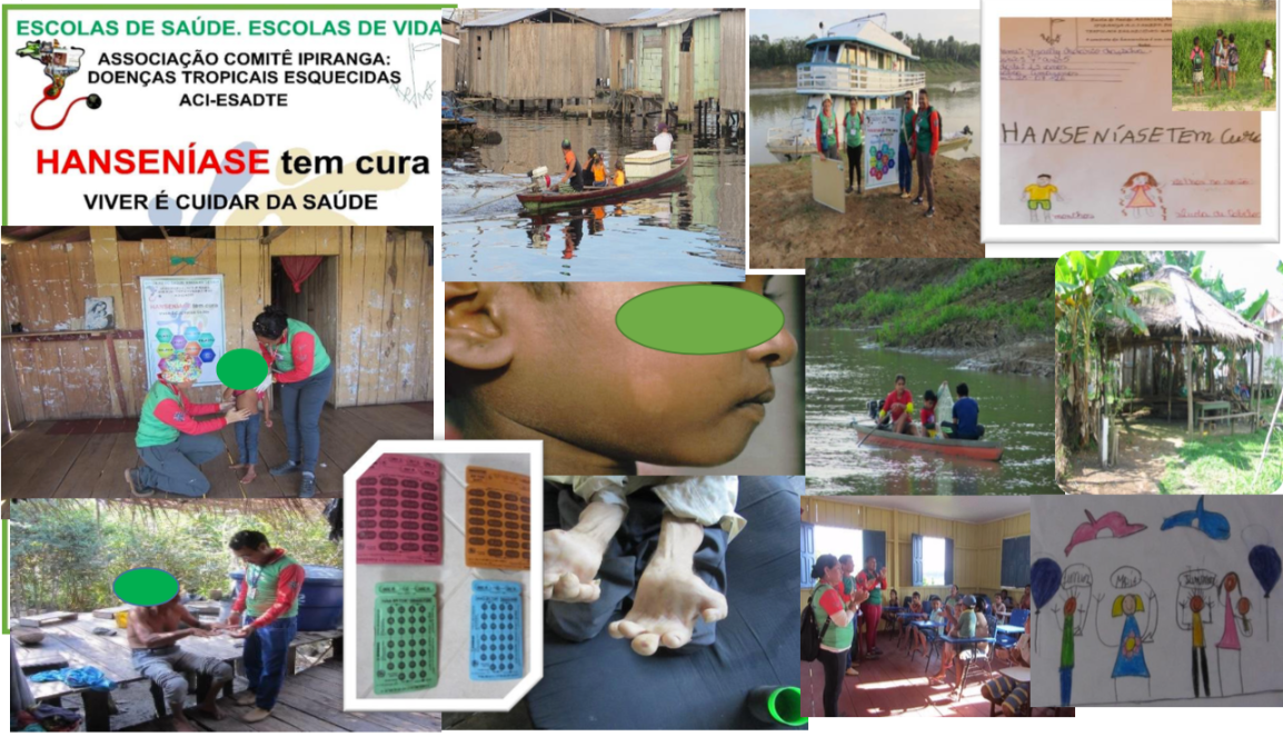 Campaña la hanseniase existe y nuestro apoyo puede&nbsp;curarla